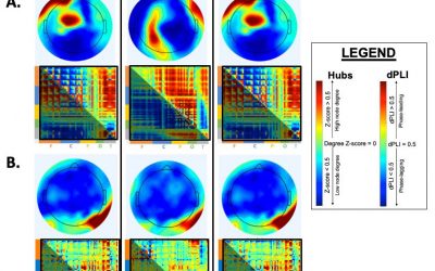 The NET-ICU Project